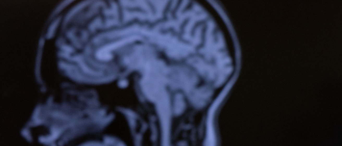 A scan of a human brain