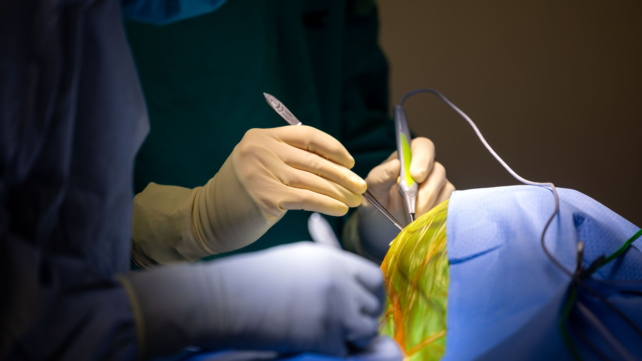Jeremy Greenlee (green coat) performs a stage 2 subthalamic nucleus (STN) deep brain simulation (DBS) surgery with post doctoral clinical trainee Juan Vivanco Suarez on Monday, Dec. 16, 2024. 